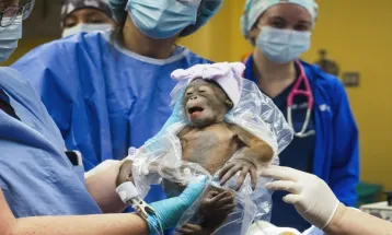 Bayi Orangutan Lahir di Amerika Serikat Melalui Operasi Caesar